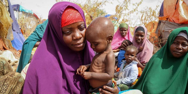 mother and malnourished child