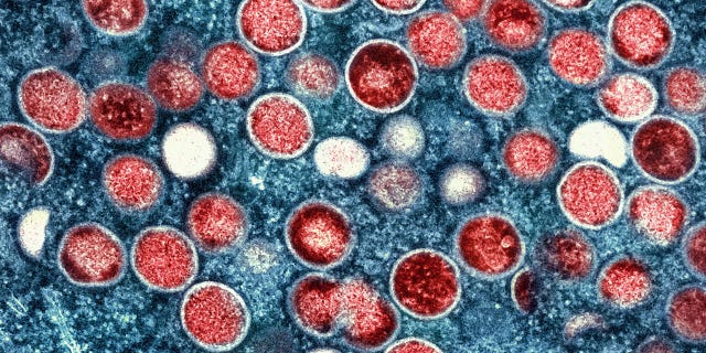 Mpox