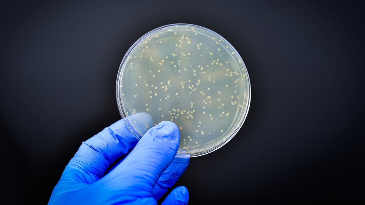 bacteria in a culture plate