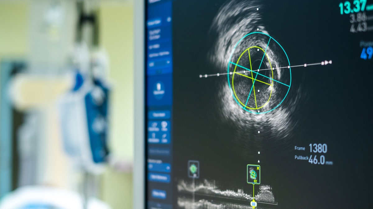 Cardiac imaging