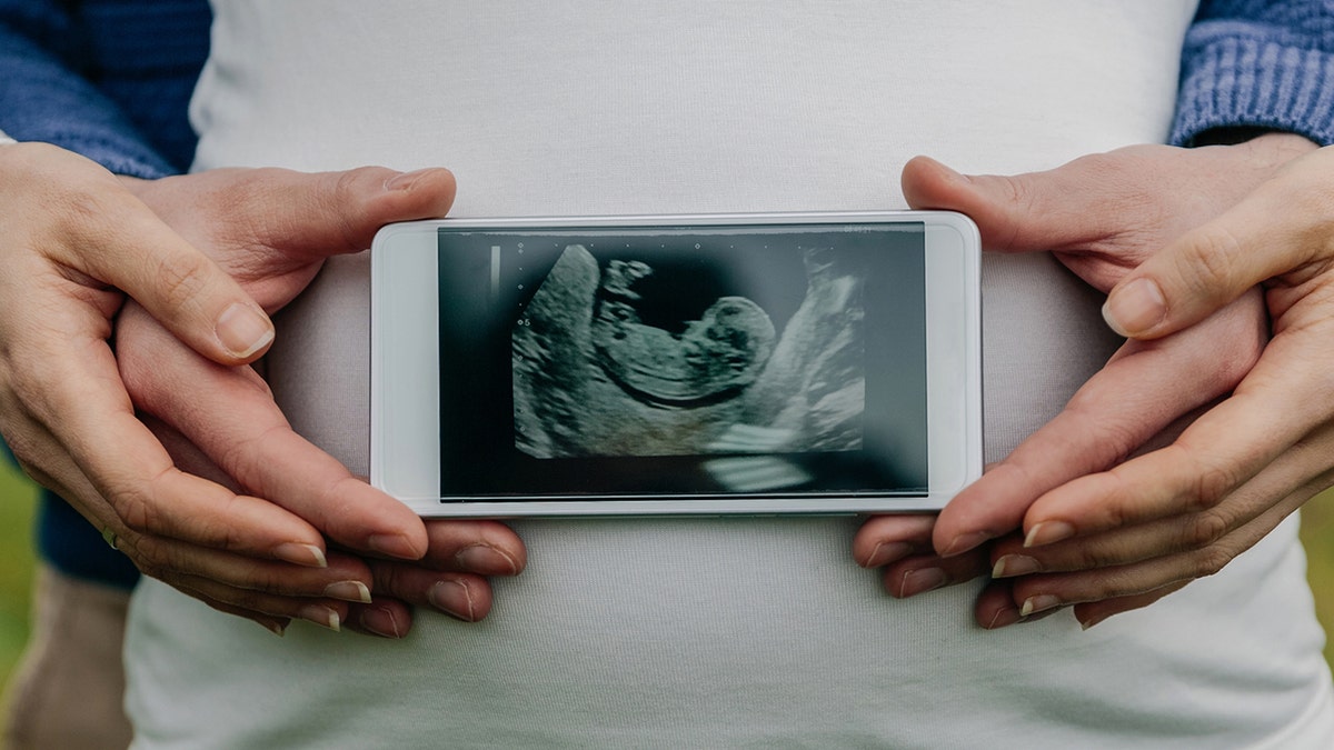 Man and woman show off baby sonogram on phone.