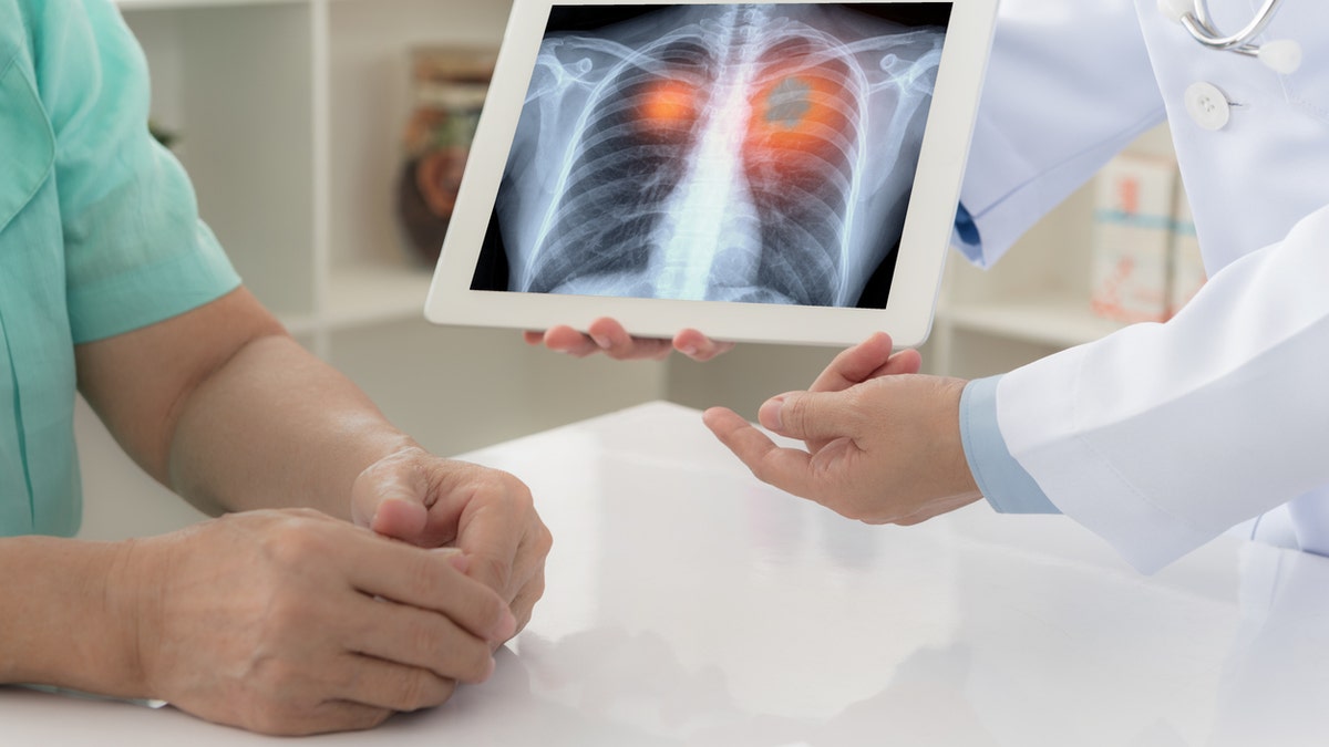 Doctor showing patients results of a lung cancer scan