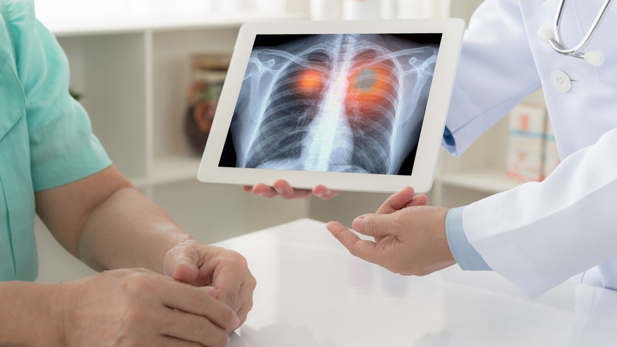 Doctor showing patients results of a lung cancer scan