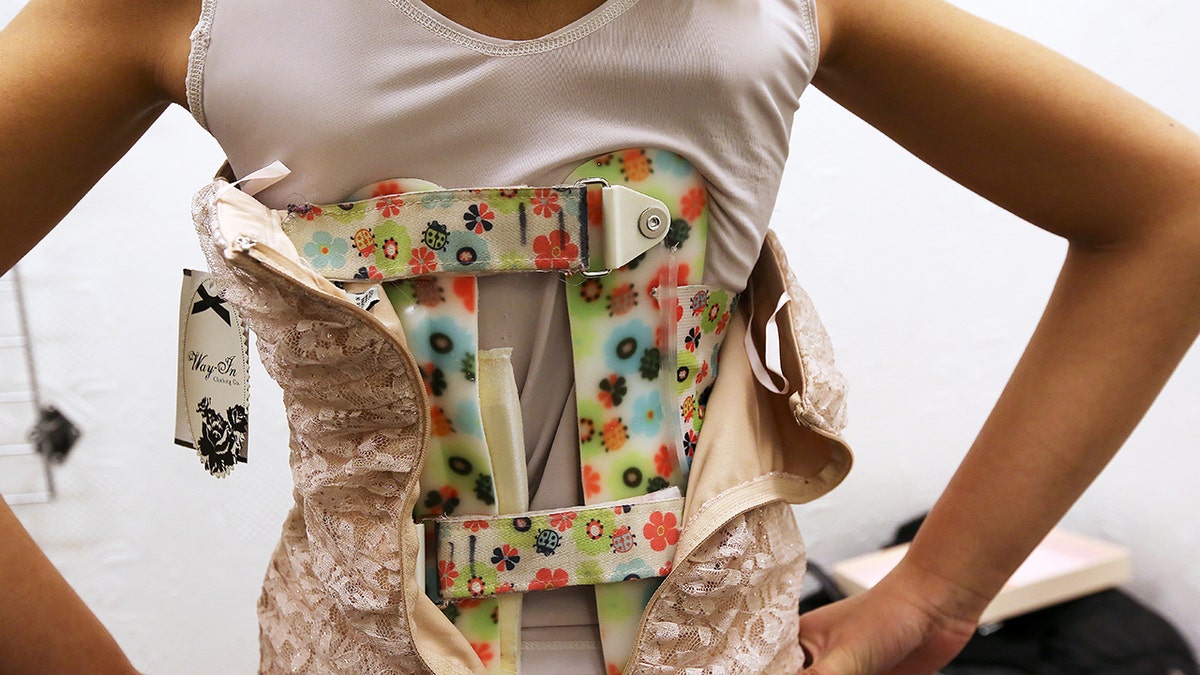 A girl wearing a back brace for scoliosis