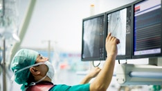 AI identified these 5 types of heart failure in new study: 'Interesting to differentiate'