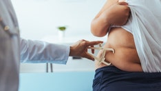 Weight loss surgeries on the rise among kids and teens, study finds: ‘Altering the anatomy’