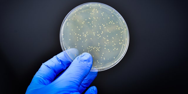 bacteria in a culture plate