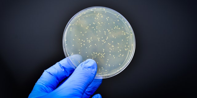 bacteria in a culture plate