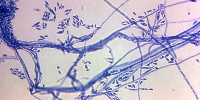 Meningitis