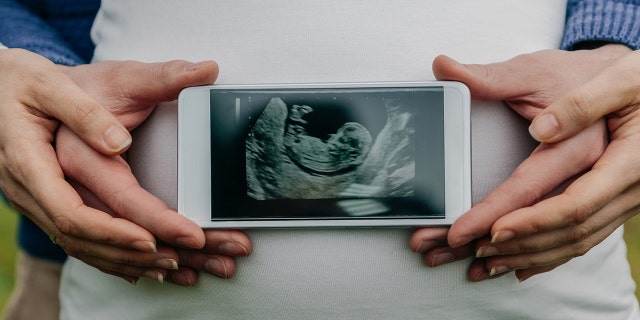 Man and woman show off baby sonogram on phone.