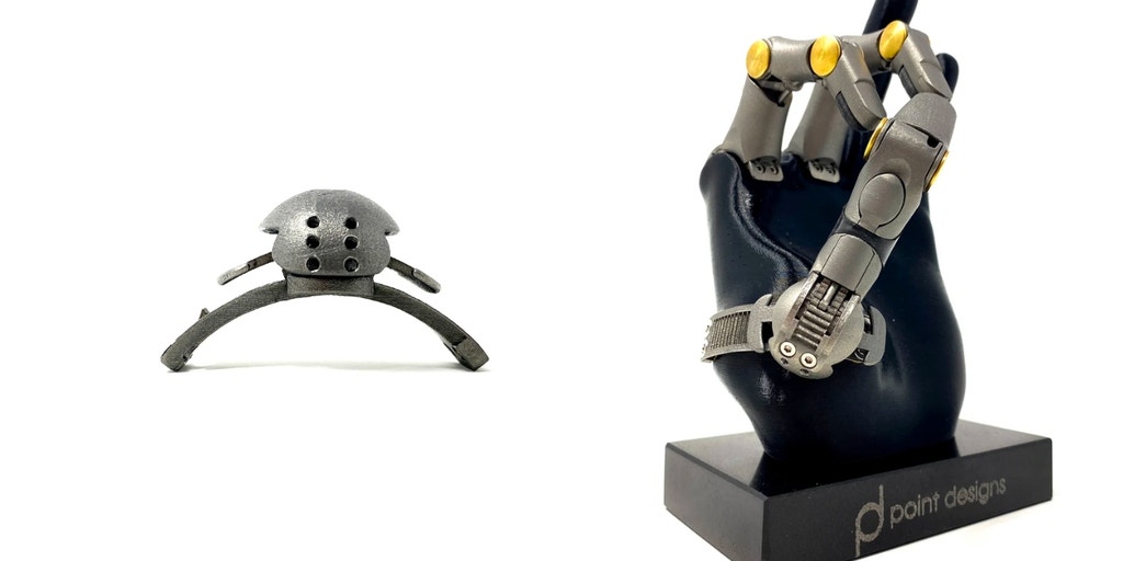 Breakthrough prosthetic fingers revolutionize the lives of amputees - Vimarsana News