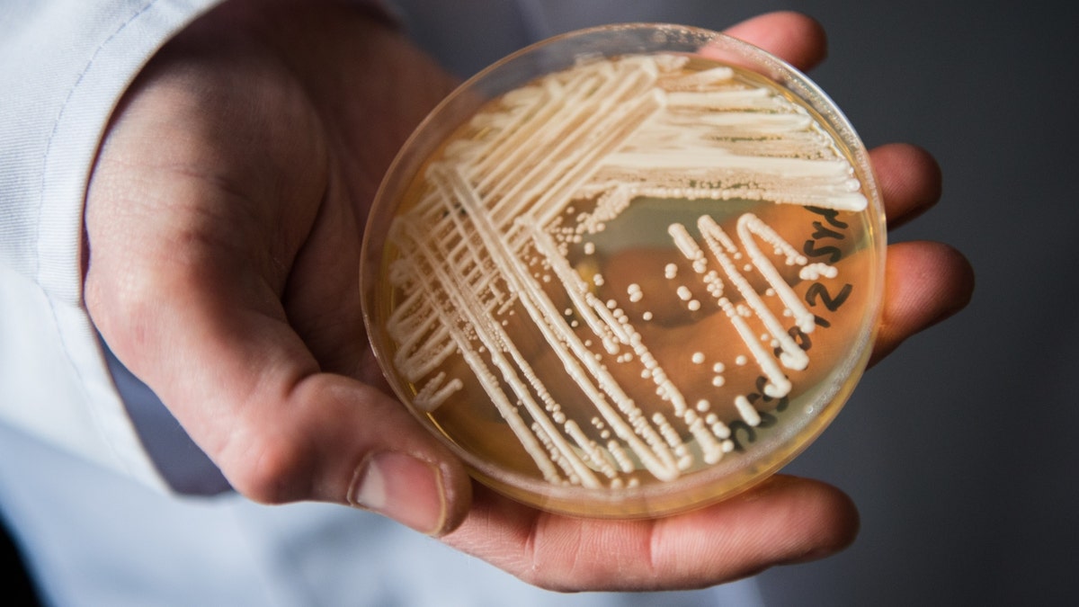 A man's hands hold a petri dish containing the yeast candida auris