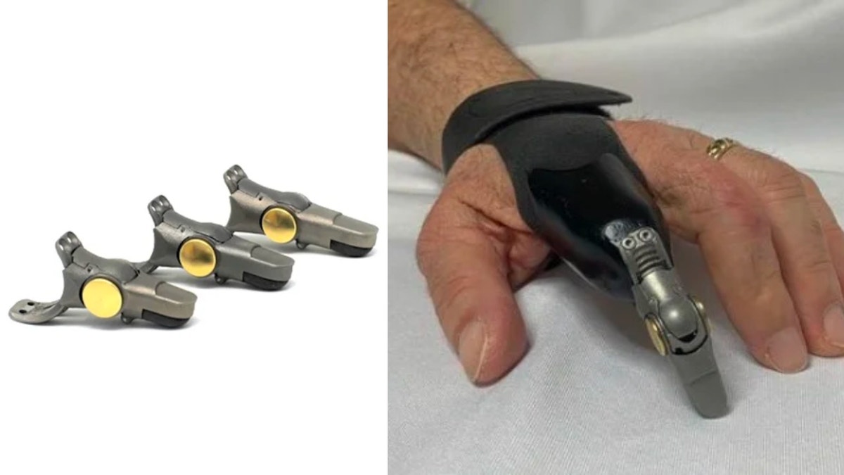 Breakthrough prosthetic fingers revolutionize the lives of amputees