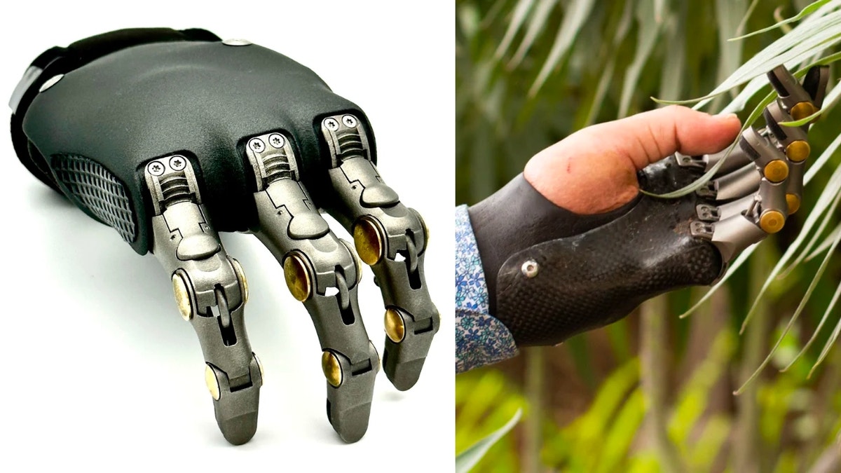 Breakthrough prosthetic fingers revolutionize the lives of