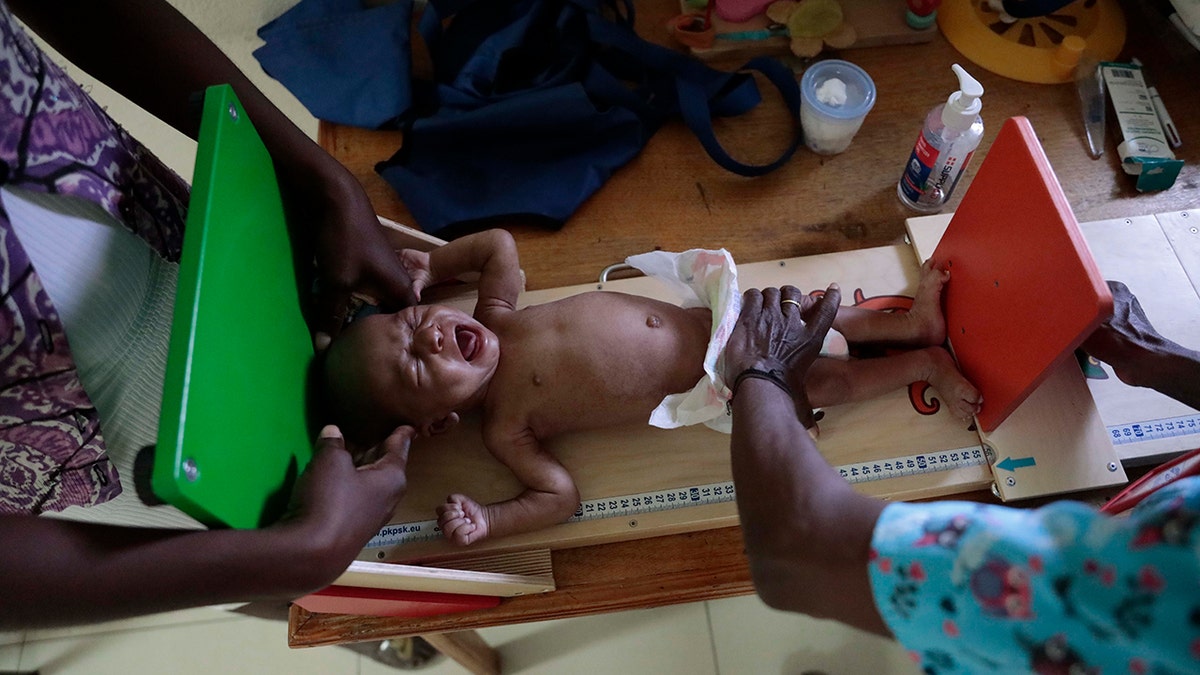 A malnourished baby