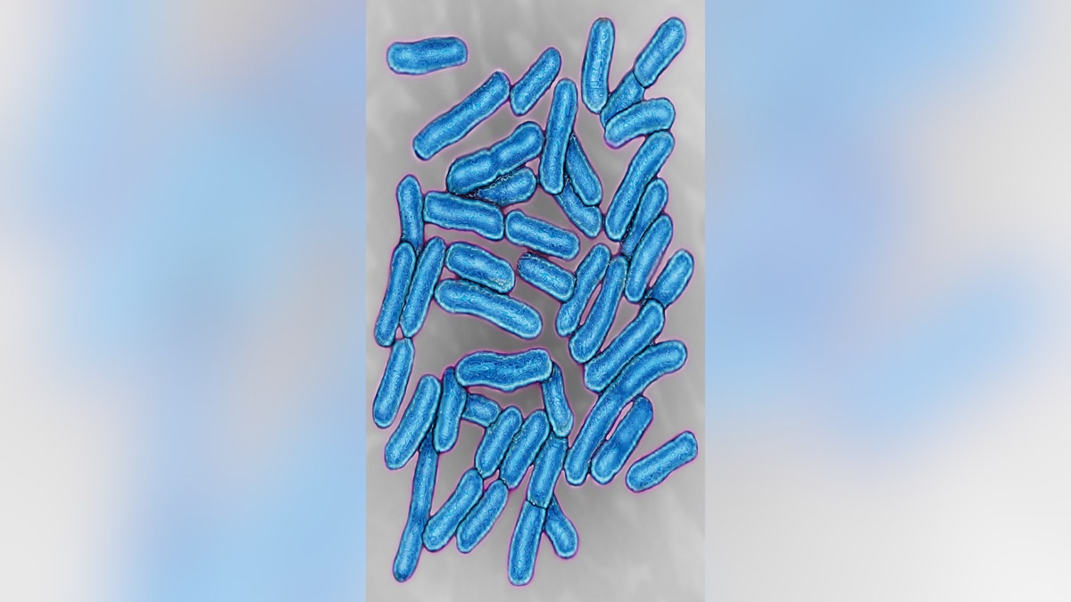 Photo of salmonella bacteria under a microscope