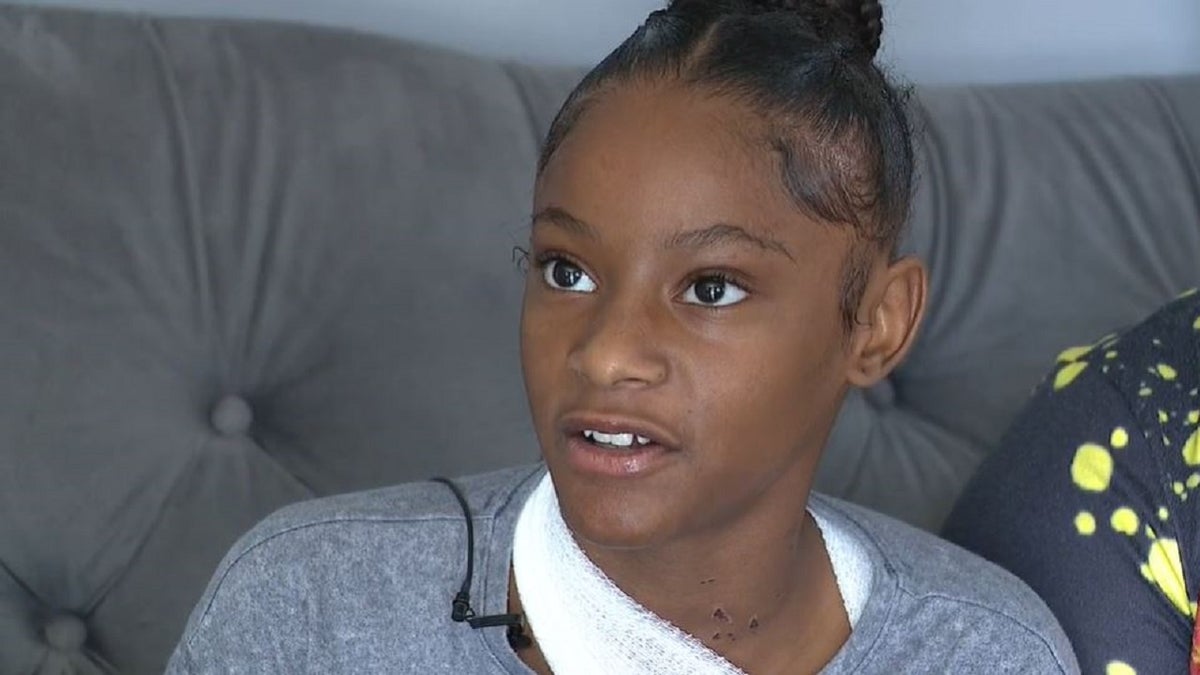 Detroit girl attacked with acid