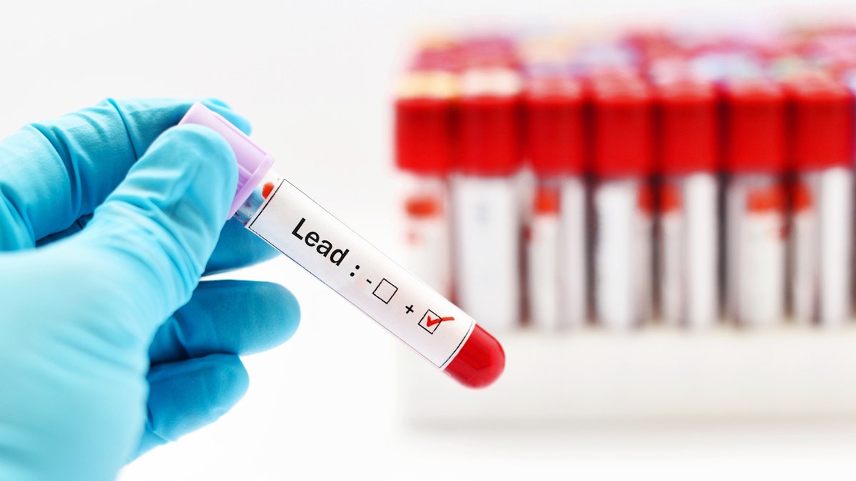 Lead blood test