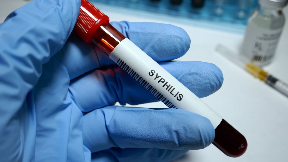 blood vial showing syphilis