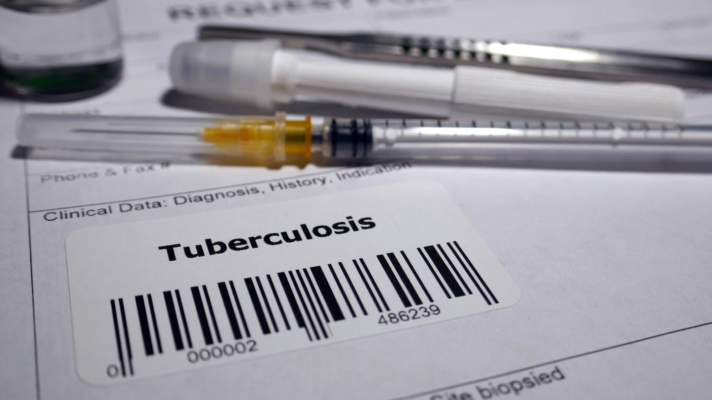 Illegal Chinese Immigrant Exposes Hundreds to Drug-Resistant Tuberculosis in Louisiana