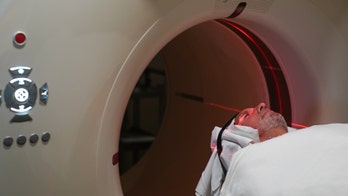 Alzheimer’s-related dementia could be prevented by experimental drug, researchers say