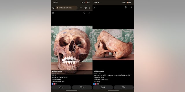 Skulls for sale on Facebook, one missing the top due to an "autopsy cut"