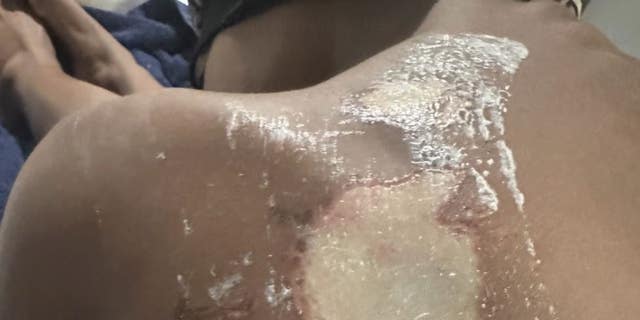 Detroit girl injured