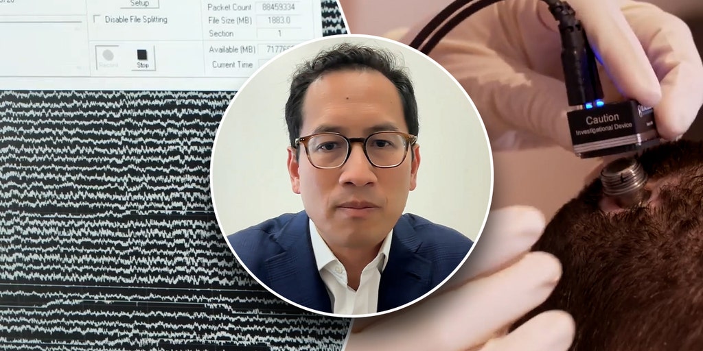 'Mind reading,' restoring vision to the blind and giving the deaf hearing could be possible: Neurosurgeon - Vimarsana News