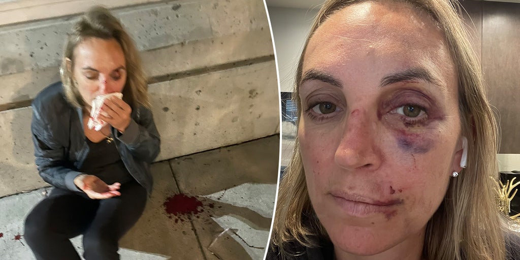 Portland woman knocked out by attacker blames city for slow police response: 'We did this to ourselves' - Vimarsana News