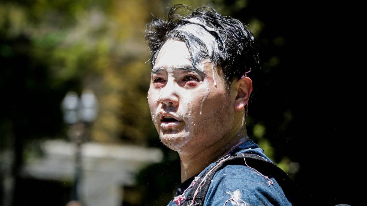 Andy Ngo after being attacked at 2019 antifa protest