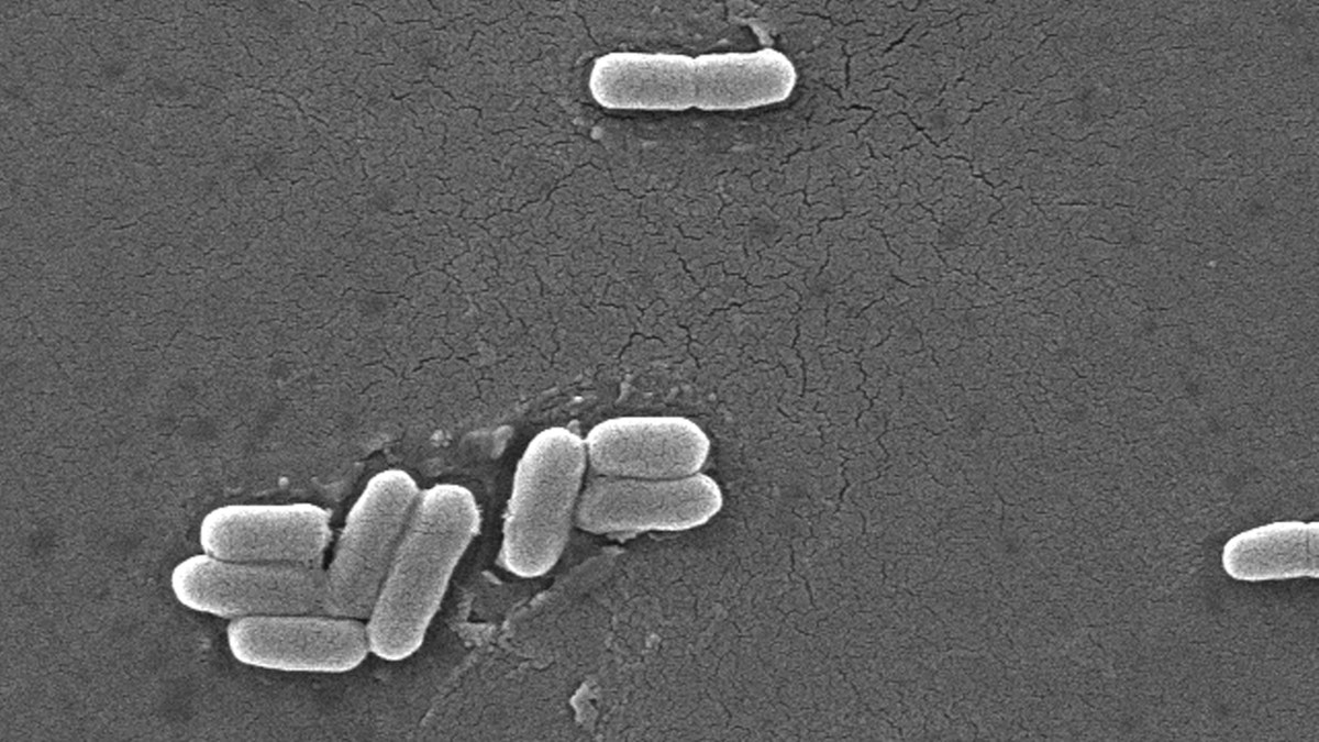 Escherichia coli bacteria of the strain O157:H7 under a microscope