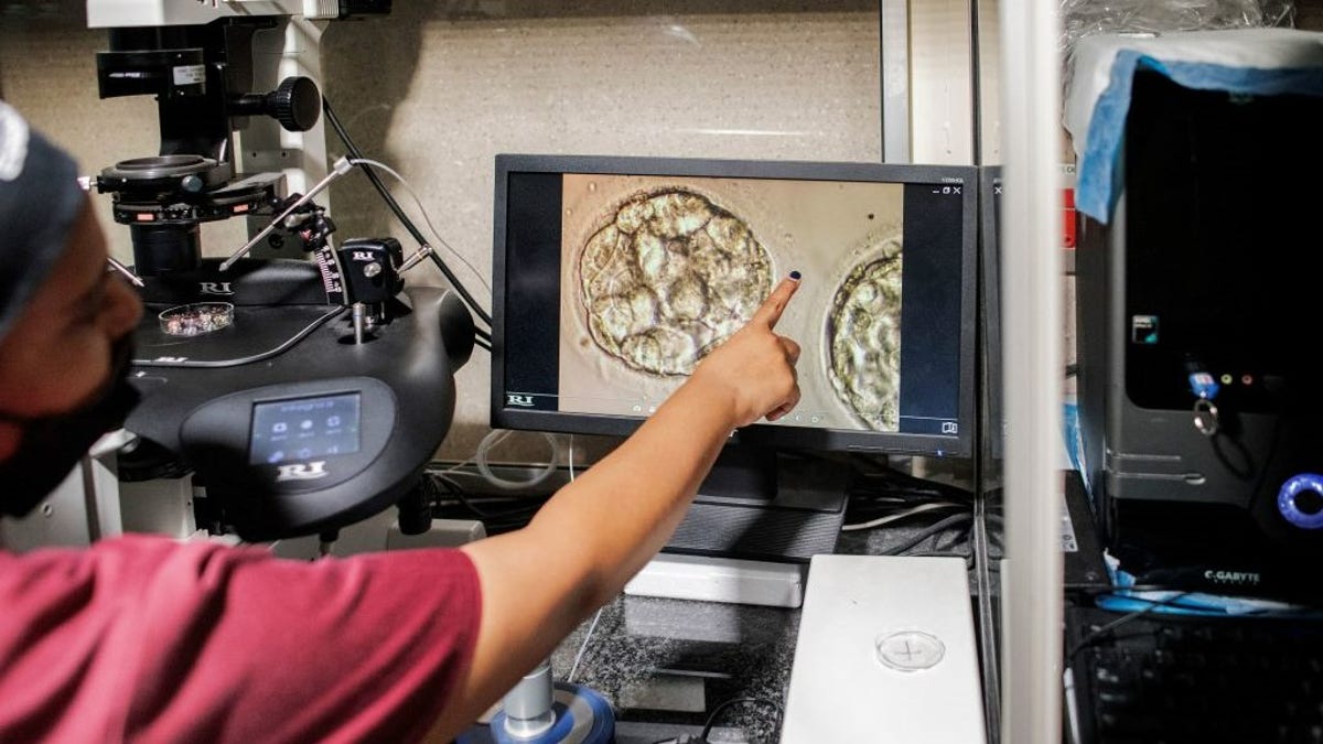 The manager of BioArt Fertility Clinics' lab prepares thawed blastocysts during an in-vitro fertilization process in Johannesburg Feb. 22, 2022. 