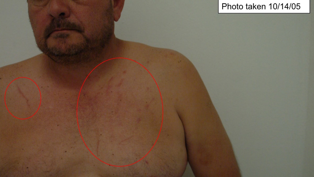 A shirtless Mario Garcia with scratchmarks on his chest