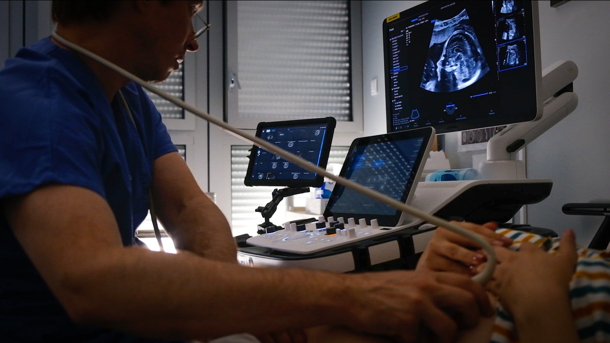 Sonio Detect ultrasound