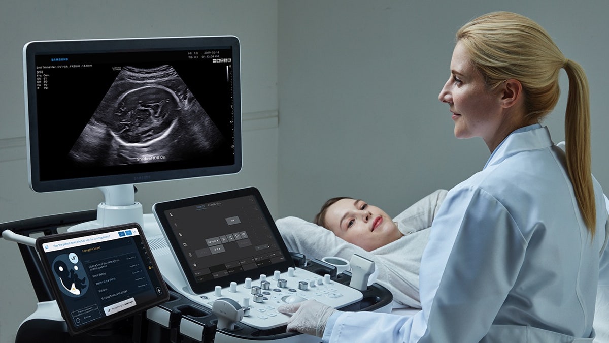 Sonio Detect AI ultrasound