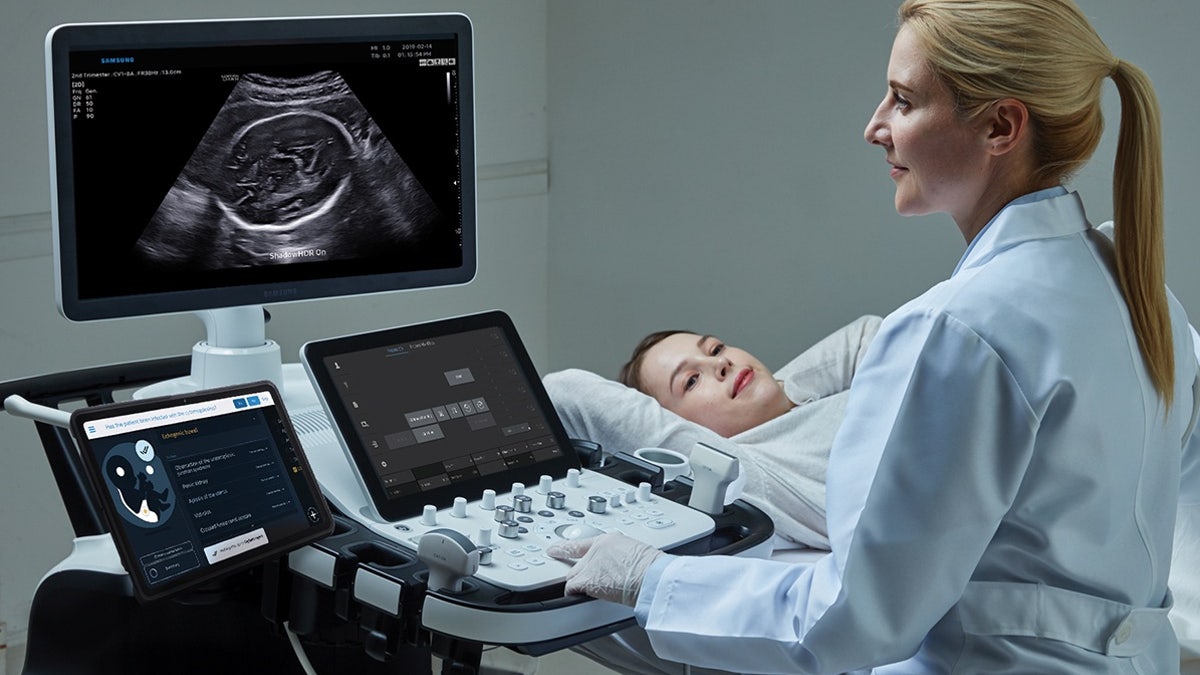 Sonio Detect AI ultrasound