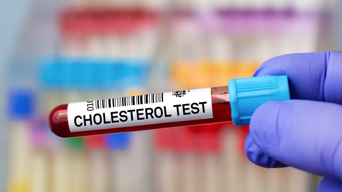 Cholesterol test