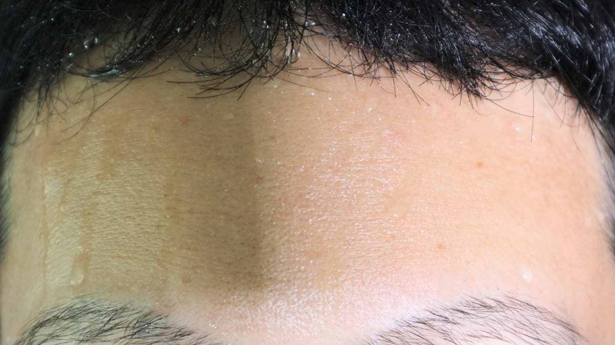 Close up of man's sweaty forehead.