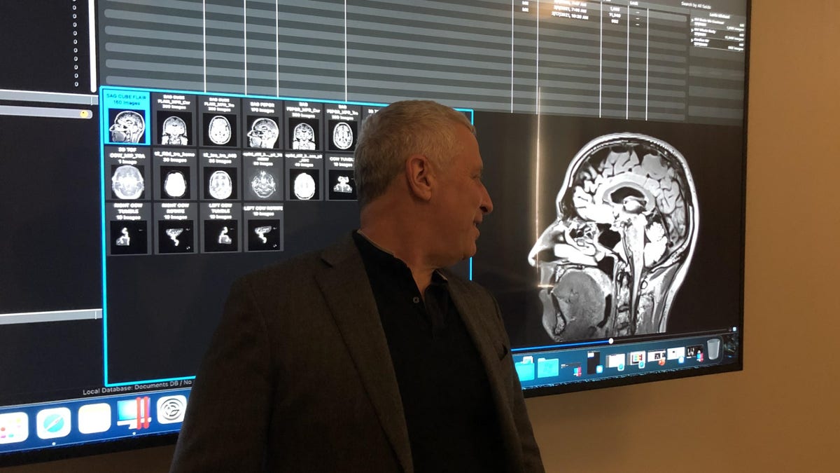 Michael Levin brain scan