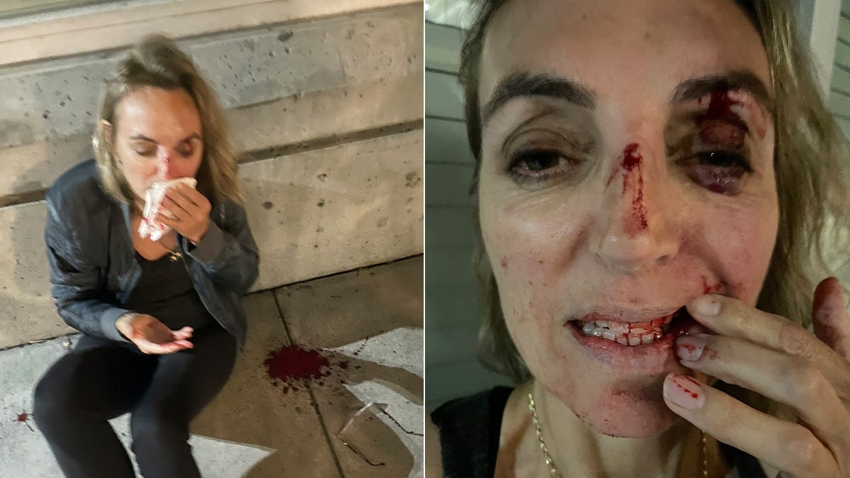 Portland woman bleeding after water bottle attack