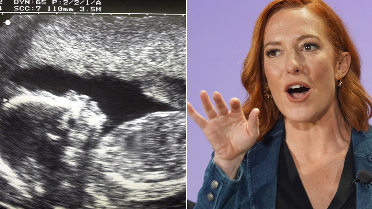 sonogram and Jen Psaki