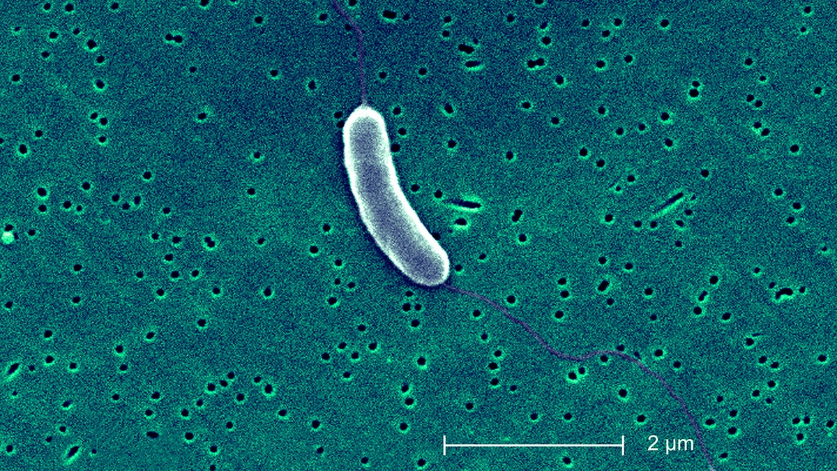 A microscope representation   of the vibrio vulnificus bacterium