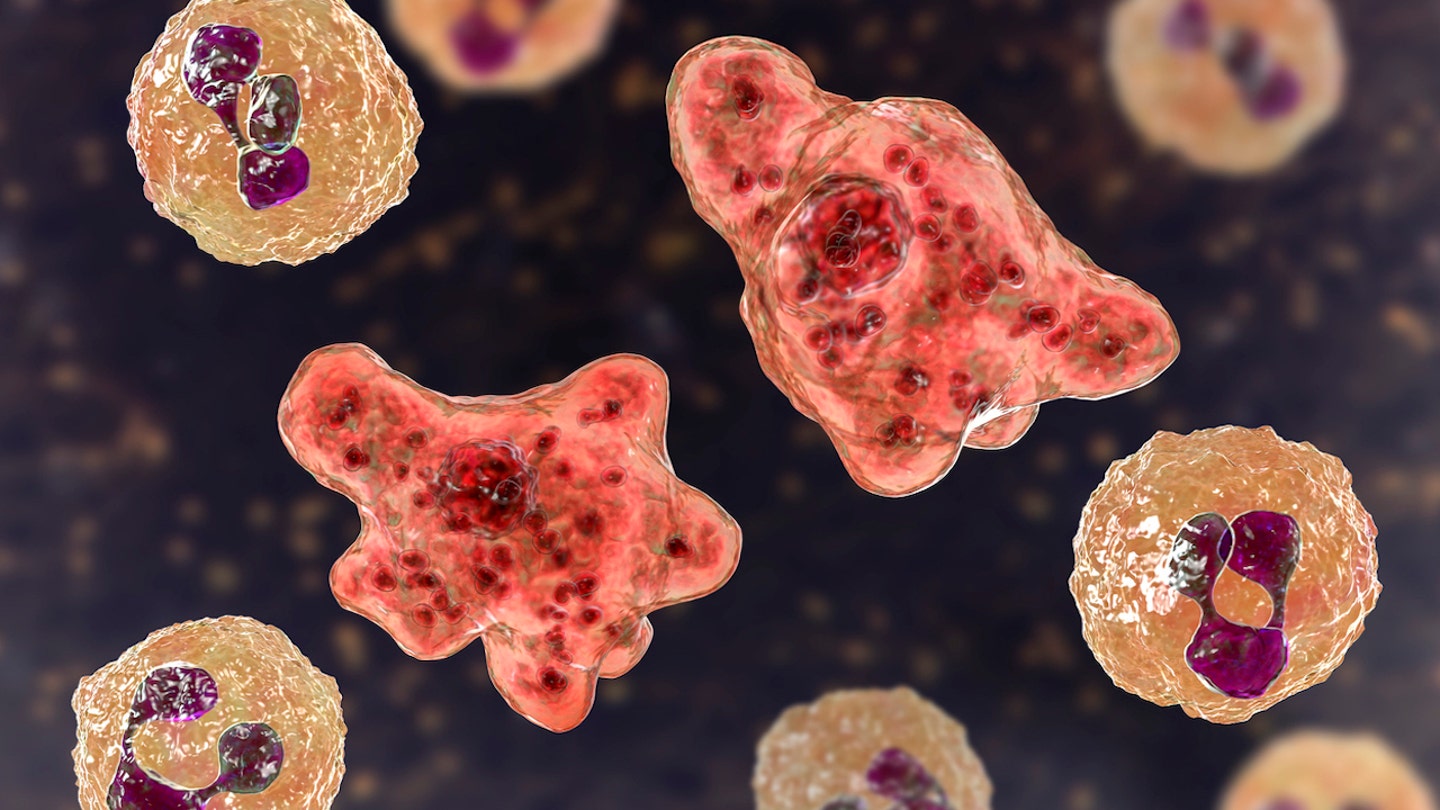 brain-eating-amoeba تموت امرأة تكساس من الأميبا التي تتناول الدماغ بعد استخدام جهاز الري الأنفي