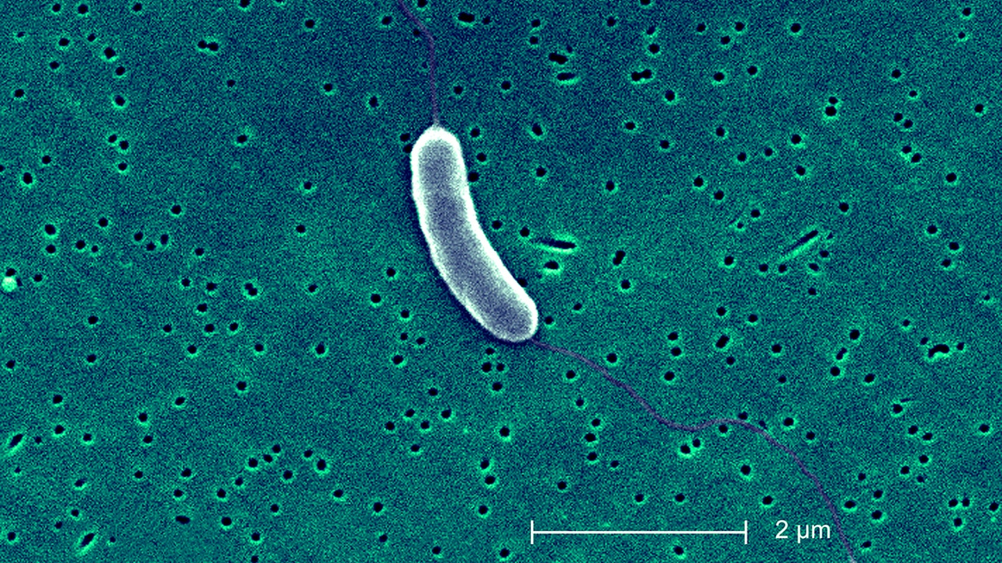 vibrio vulnificus bacterium