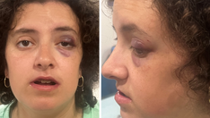 Maryland special needs woman mocked, assaulted by group on Rockville bus: police