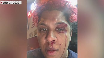 First responder recounts brutal assault while on the job as staffing shortages plague nation