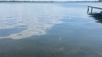 Texas resident dies from rare amoeba infection after swimming in lake