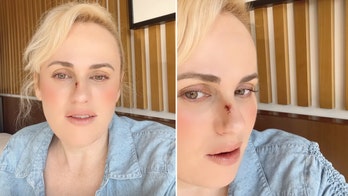 Rebel Wilson gets stitches after being injured by prop gun on movie set