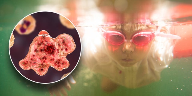 Brain-eating Amoebas: What You Must Know About The Risk Of Swimming In ...