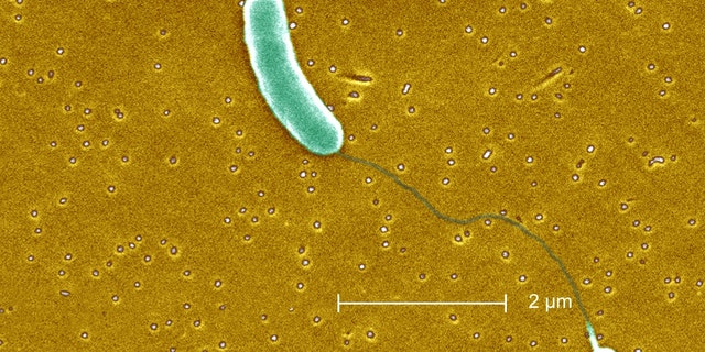 Vibrio vulnificus infections